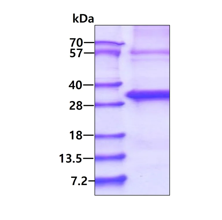SDS-PAGE - Recombinant Human ABHD12B protein (denatured) (AB181894)