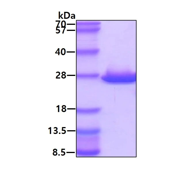 SDS-PAGE - Recombinant Human ABHD14B protein (His tag N-Terminus) (AB123190)
