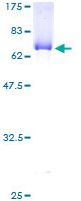 SDS-PAGE - Recombinant Human Abhd5/CGI-58 protein (AB132557), expandable thumbnail