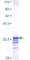 SDS-PAGE - Recombinant Human Abi-1 protein (AB160761)