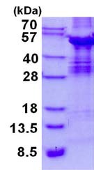 SDS-PAGE - Recombinant Human ABI3 protein (denatured) (His tag N-Terminus) (AB134548)
