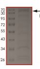 SDS-PAGE - Recombinant human ABL1 (mutated F317L) protein (Active) (AB206003), expandable thumbnail