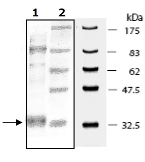 SDS-PAGE - Recombinant human ABL1 (mutated T315I) protein (Active) (His tag N-Terminus) (AB196134)