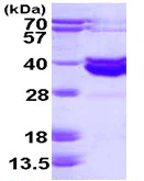 SDS-PAGE - Recombinant Human ABO protein (His tag N-Terminus) (AB113153)