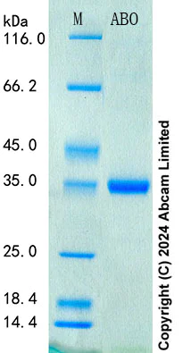SDS-PAGE - Recombinant Human ABO Protein Standard (His tag) (AB322756)