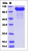 SDS-PAGE - Recombinant Human ABP1 protein (His tag) (AB276566)