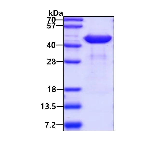 SDS-PAGE - Recombinant Human ACAA1/Beta-ketothiolase protein (AB98236)