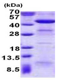 Recombinant Human ACAA2 protein