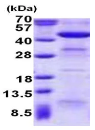 SDS-PAGE - Recombinant Human ACAA2 protein (His tag N-Terminus) (AB140734)