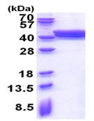 SDS-PAGE - Recombinant Human ACAD8 protein (His tag N-Terminus) (AB174555)