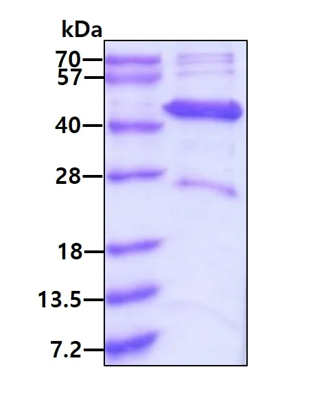 SDS-PAGE - Recombinant Human ACADL/LCAD protein (AB113579)