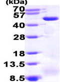 SDS-PAGE - Recombinant Human ACADM/MCAD protein (His tag N-Terminus) (AB99329)