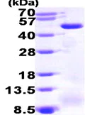 SDS-PAGE - Recombinant Human ACADM/MCAD protein (His tag N-Terminus) (AB99329)