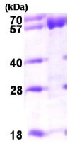 SDS-PAGE - Recombinant Human ACADVL/VLCAD protein (AB98234)
