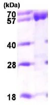 SDS-PAGE - Recombinant Human ACADVL/VLCAD protein (AB98234)