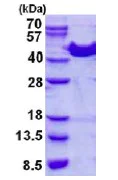 SDS-PAGE - Recombinant Human ACAT1 protein (AB137175)