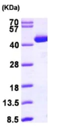 SDS-PAGE - Recombinant Human ACAT2/Acetyl-CoA acetyltransferase protein (His tag N-Terminus) (AB98082)