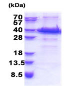 SDS-PAGE - Recombinant Human ACBD6 protein (His tag N-Terminus) (AB171507)
