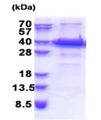 SDS-PAGE - Recombinant Human ACBD6 protein (His tag N-Terminus) (AB171507)