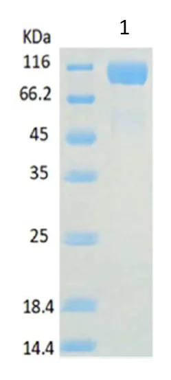 Western blot - Recombinant Human ACE2 protein (AB151852)