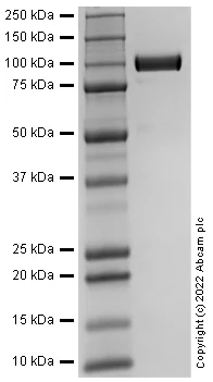 SDS-PAGE - Recombinant Human ACE2 protein (Active) (AB287935)