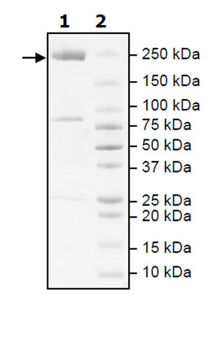 SDS-PAGE - Recombinant human Acetyl Coenzyme A Carboxylase beta protein (Active) (AB271358)