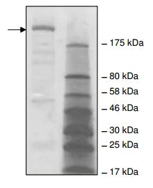 SDS-PAGE - Recombinant human Acetyl Coenzyme A Carboxylase protein (AB196428)