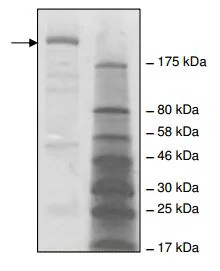SDS-PAGE - Recombinant human Acetyl Coenzyme A Carboxylase protein (DDDDK tag C-Terminus + His tag C-Terminus) (AB196428)