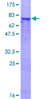 SDS-PAGE - Recombinant Human Aciculin protein (GST tag N-Terminus) (AB159104)