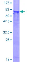SDS-PAGE - Recombinant Human Aciculin protein (GST tag N-Terminus) (AB159104)