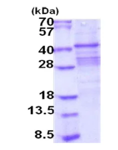 SDS-PAGE - Recombinant Human Acid Phosphatase 2 protein (denatured) (AB202151)