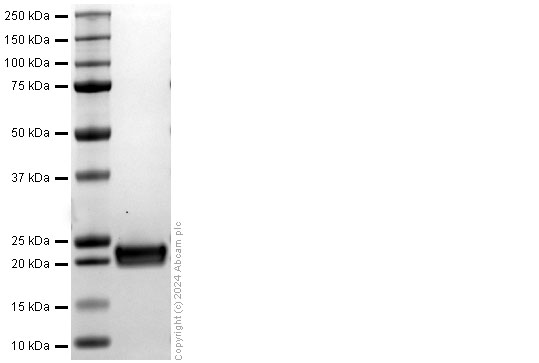 SDS-PAGE - Recombinant human Acid phosphatase/ACP1 protein (His-tag) (AB322311), expandable thumbnail