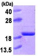 SDS-PAGE - Recombinant human Acid phosphatase/ACP1 protein (His tag N-Terminus) (AB87493)
