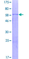 SDS-PAGE - Recombinant Human Acid sphingomyelinase protein (AB132844), expandable thumbnail