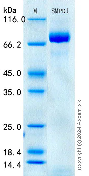 SDS-PAGE - Recombinant Human Acid sphingomyelinase Protein Standard (His tag) (AB316405)