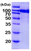 SDS-PAGE - Recombinant Human Aconitase 1/ACO1 protein (AB103501)