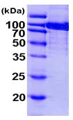 SDS-PAGE - Recombinant Human Aconitase 1/ACO1 protein (AB103501)