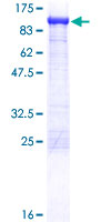 SDS-PAGE - Recombinant Human Aconitase 2 protein (GST tag N-Terminus) (AB114378)