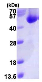 SDS-PAGE - Recombinant Human ACOT7 protein (AB123169)