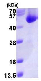 SDS-PAGE - Recombinant Human ACOT7 protein (His tag N-Terminus) (AB123169)