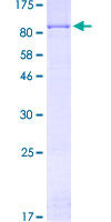 SDS-PAGE - Recombinant Human ACOX3 protein (AB159987)