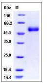 SDS-PAGE - Recombinant Human ACPL2 protein (His tag) (AB276376), expandable thumbnail