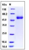 SDS-PAGE - Recombinant Human ACPL2 protein (His tag) (AB276376)