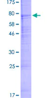 SDS-PAGE - Recombinant Human Acrosin protein (AB157832)