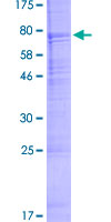 SDS-PAGE - Recombinant Human Acrosin protein (GST tag N-Terminus) (AB157832)