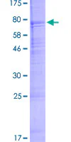 SDS-PAGE - Recombinant Human Acrosin protein (GST tag N-Terminus) (AB157832)