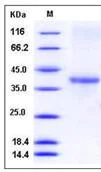 SDS-PAGE - Recombinant Human ACRV1 protein (His tag) (AB276432)