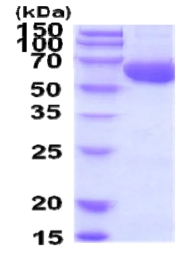SDS-PAGE - Recombinant Human ACSF2 protein (AB207118)