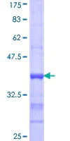 SDS-PAGE - Recombinant Human ACSL1 protein (AB116839)