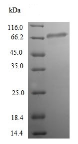SDS-PAGE - Recombinant Human ACSS1 protein (His tag) (AB239557)